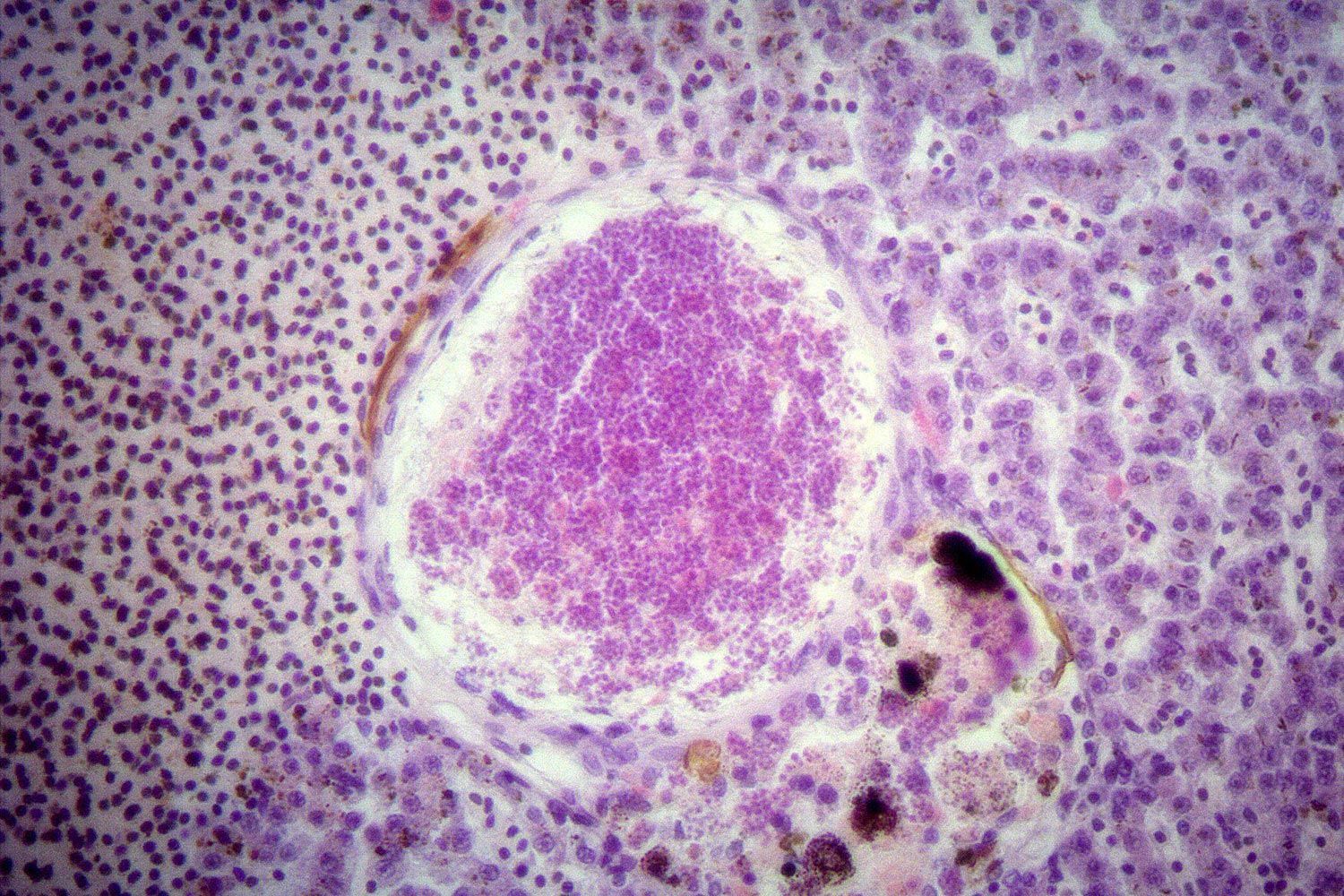 ENDOCRINOLOGY