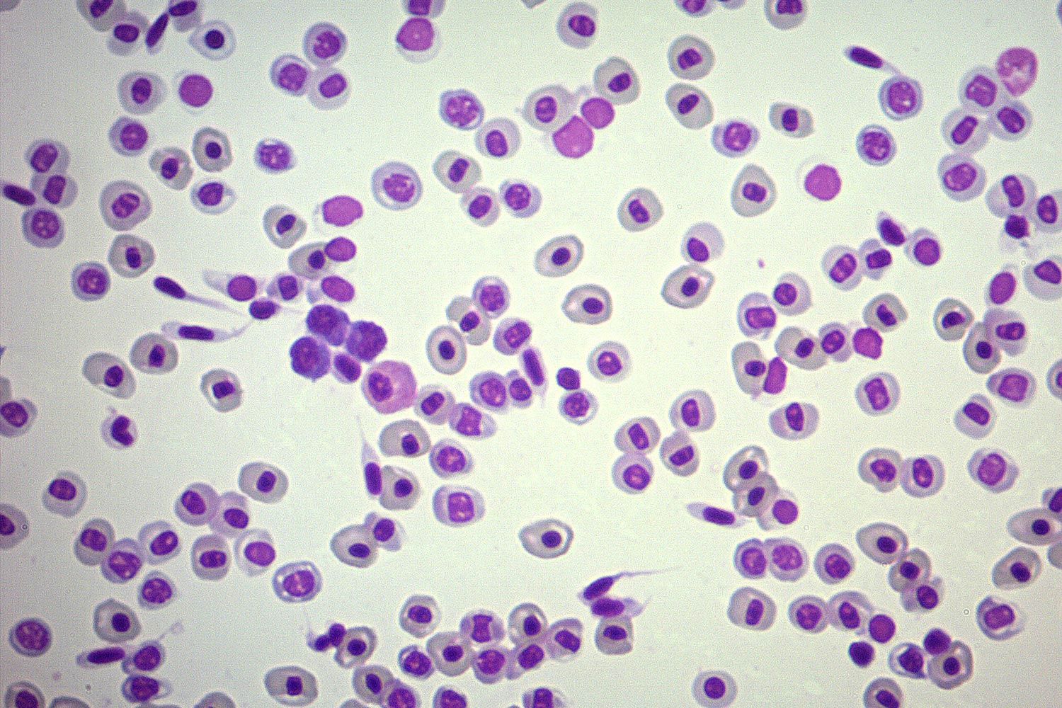 HAEMATOLOGY